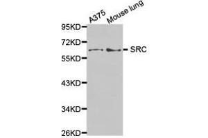 Western Blotting (WB) image for anti-Proto-oncogene tyrosine-protein kinase Src (Src) antibody (ABIN1874936) (Src anticorps)