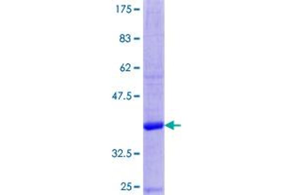 DEFa3 Protein (AA 1-94) (GST tag)