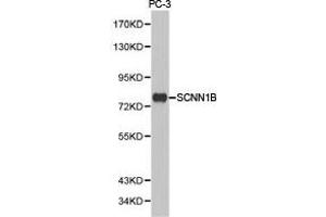 Western Blotting (WB) image for anti-Sodium Channel, Nonvoltage-Gated 1, beta (SCNN1B) antibody (ABIN1874704) (SCNN1B anticorps)