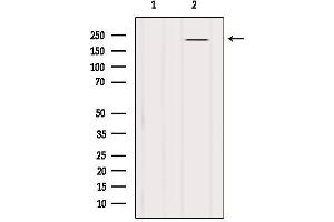 Western blot analysis of extracts from B16F10, using BRCA1 Antibody. (BRCA1 anticorps  (Internal Region))