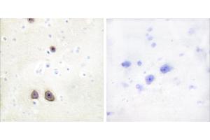 Peptide - + (RBM39 anticorps  (Internal Region))