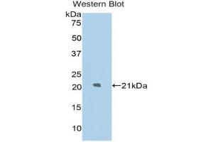 Western Blotting (WB) image for anti-Lysosomal-Associated Membrane Protein 2 (LAMP2) (AA 191-362) antibody (ABIN1174646) (LAMP2 anticorps  (AA 191-362))