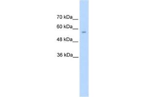 Western Blotting (WB) image for anti-Dopa Decarboxylase (Aromatic L-Amino Acid Decarboxylase) (DDC) antibody (ABIN2462405) (DDC anticorps)