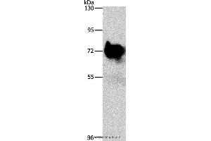 Western blot analysis of Mouse brain tissue, using SYN1 Polyclonal Antibody at dilution of 1:750 (SYN1 anticorps)