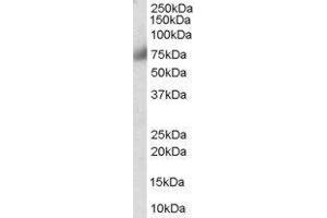 Western Blotting (WB) image for Fibroblast Growth Factor Receptor 1 (FGFR1) peptide (ABIN369421) (Fibroblast Growth Factor Receptor 1 (FGFR1) Peptide)