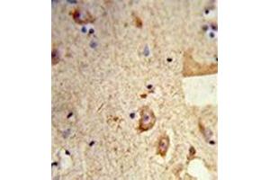 Formalin-fixed and paraffin-embedded human brain tissue reacted with Destrin Antibody , which was peroxidase-conjugated to the secondary antibody, followed by DAB staining. (Destrin anticorps  (Middle Region))