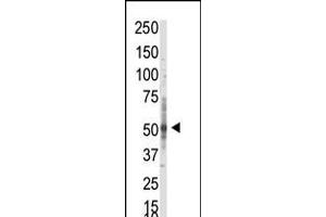 Western blot analysis of anti-PRMT3 Pab in whole HL60 cell lysate: PRMT3 was detected using purified Pab. (PRMT3 anticorps  (N-Term))