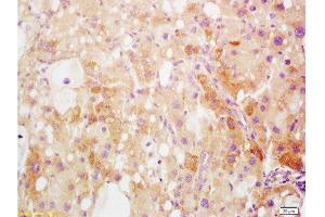 Immunohistochemistry (Paraffin-embedded Sections) (IHC (p)) image for anti-High Mobility Group Box 1 (HMGB1) (AA 75-170) antibody (ABIN671616)