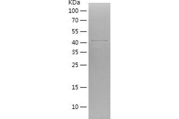 GREM1 Protein (AA 25-184) (His-IF2DI Tag)