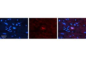 Rabbit Anti-JUNB Antibody   Formalin Fixed Paraffin Embedded Tissue: Human heart Tissue Observed Staining: Nucleus Primary Antibody Concentration: 1:100 Other Working Concentrations: N/A Secondary Antibody: Donkey anti-Rabbit-Cy3 Secondary Antibody Concentration: 1:200 Magnification: 20X Exposure Time: 0. (JunB anticorps  (N-Term))
