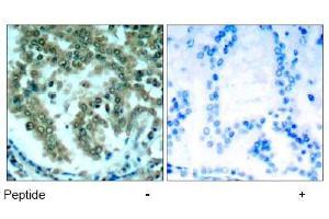 Image no. 1 for anti-Protein Kinase C, theta (PRKCQ) (AA 674-678) antibody (ABIN197567) (PKC theta anticorps  (AA 674-678))