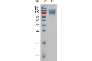 Mouse B7-H2 Protein, hFc Tag on SDS-PAGE under reducing condition. (ICOSLG Protein (AA 47-279) (Fc Tag))