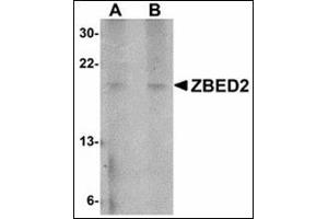 Western blot analysis of ZBED2 in A549 cell lysate with ZBED2 antibody at (A) 1 and (B) 2 µg/ml. (ZBED2 anticorps  (N-Term))