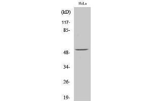Western Blotting (WB) image for anti-Activating Transcription Factor 2 (ATF2) (pSer62) antibody (ABIN3179390) (ATF2 anticorps  (pSer62))