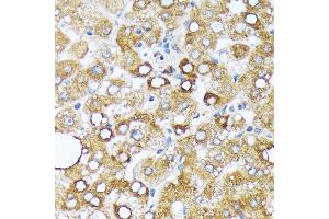 Immunohistochemistry of paraffin-embedded human liver using Cytochrome P450 4A (CYP4) (CYP4) Rabbit mAb (ABIN7266658) at dilution of 1:100 (40x lens). (CYP4A11 anticorps)