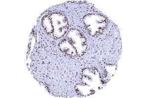 Prostate A strong nuclear AR immunostaining is seen in stromal and epithelial cells of the prostate. (Recombinant Androgen Receptor anticorps  (AA 1-100))