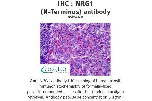Image no. 1 for anti-Neuregulin 1 (NRG1) (Isoform 10) antibody (ABIN1737529) (Neuregulin 1 anticorps  (Isoform 10))
