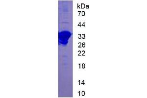 SDS-PAGE (SDS) image for Chemokine (C-C Motif) Ligand 7 (CCL7) ELISA Kit (ABIN6574138)