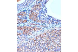 Immunohistochemistry of paraffin-embedded Rat ovary using B3GNT3 Rabbit pAb (ABIN7271204) at dilution of 1:100 (40x lens). (B3GNT3 anticorps  (AA 120-240))