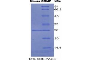 SDS-PAGE analysis of Mouse COMP Protein. (COMP Protéine)