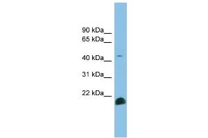 WB Suggested Anti-TGFB2 Antibody Titration: 0. (TGFB2 anticorps  (Middle Region))