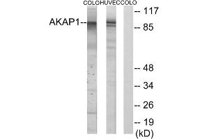 Western blot analysis of extracts from HUVEC cells and COLO cells, using AKAP1 antibody. (AKAP1 anticorps  (Internal Region))