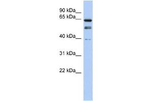 Western Blotting (WB) image for anti-MYST Histone Acetyltransferase 2 (MYST2) antibody (ABIN2457900) (MYST2 anticorps)