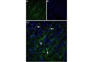 Expression of TRPC5 in rat cortex - Immunohistochemical staining of rat cortex using Anti-TRPC5 Antibody (ABIN7043823, ABIN7043974 and ABIN7043975). (TRPC5 anticorps  (C-Term, Intracellular))