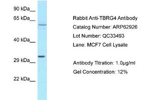 Western Blotting (WB) image for anti-Transforming Growth Factor beta Regulator 4 (TBRG4) (C-Term) antibody (ABIN971852) (TBRG4 anticorps  (C-Term))