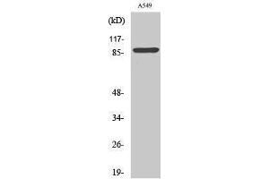 Western Blotting (WB) image for anti-Integrin AlphaV HC (Lys889) antibody (ABIN3181844) (Integrin AlphaV HC (Lys889) anticorps)