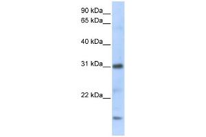 WB Suggested Anti-CXCL16 Antibody Titration:  0. (CXCL16 anticorps  (C-Term))