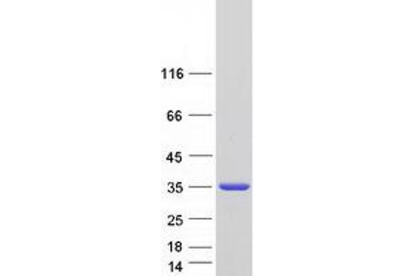 FAHD1 Protein (Transcript Variant 2) (Myc-DYKDDDDK Tag)