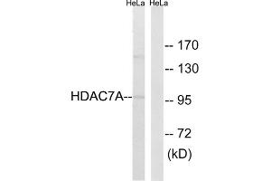 Western blot analysis of extracts from HeLa cells, using HDAC7A (epitope around residue 155) antibody. (HDAC7 anticorps  (Ser155))