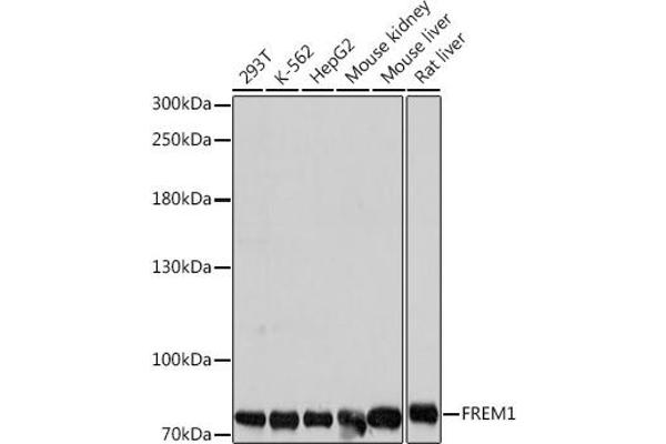 FREM1 anticorps  (AA 1880-2179)
