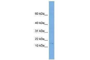 FHIT antibody used at 1 ug/ml to detect target protein. (FHIT anticorps  (Middle Region))