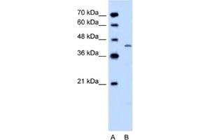Western Blotting (WB) image for anti-Dihydroorotate Dehydrogenase (DHODH) antibody (ABIN2462506) (DHODH anticorps)