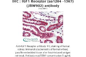 Image no. 2 for anti-Insulin-Like Growth Factor 1 Receptor (IGF1R) (AA 1264-1367) antibody (ABIN1723400) (IGF1R anticorps  (AA 1264-1367))