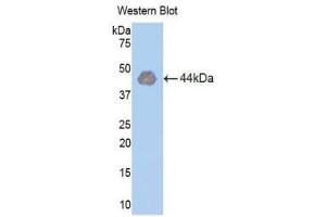 Western Blotting (WB) image for anti-Hexokinase 1 (HK1) (AA 413-540) antibody (ABIN1859172) (Hexokinase 1 anticorps  (AA 413-540))