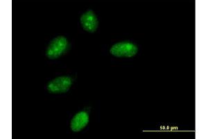 Immunofluorescence of purified MaxPab antibody to NMNAT1 on HeLa cell. (NMNAT1 anticorps  (AA 1-279))
