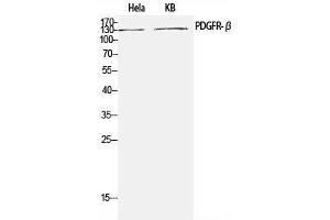 Western Blot analysis of Hela, KB cells using PDGFRB Polyclonal Antibody at dilution of 1:1000. (PDGFRB anticorps)