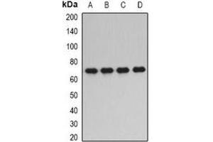 Western blot analysis of PPP2R1A expression in SKOV3 (A), HepG2 (B), mouse brain (C), mouse kidney (D) whole cell lysates. (PPP2R1A anticorps)