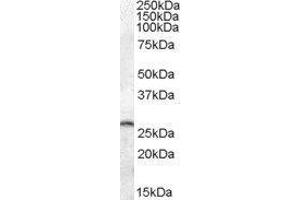 Western Blotting (WB) image for Phosphoserine Phosphatase (PSPH) peptide (ABIN370330) (Phosphoserine Phosphatase (PSPH) Peptide)