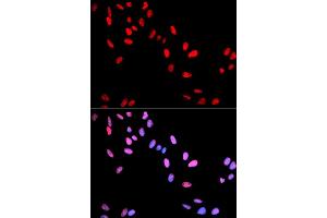 Immunofluorescence analysis of U2OS cells using Phospho-MYC-T58 antibody (ABIN5969925). (c-MYC anticorps  (pThr58))