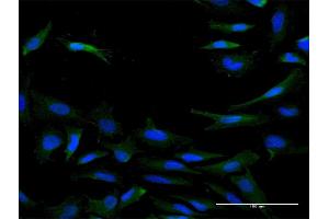 Immunofluorescence of purified MaxPab antibody to IL20RB on HeLa cell. (IL20RB anticorps  (AA 1-147))