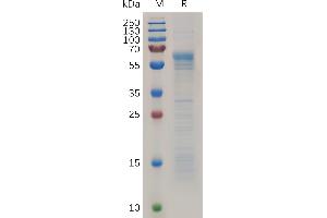 Human PRNP Protein, hFc Tag on SDS-PAGE under reducing condition. (PRNP Protein (AA 23-229) (Fc Tag))