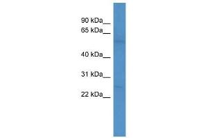 Western Blot showing PDE1A antibody used at a concentration of 1-2 ug/ml to detect its target protein. (PDE1A anticorps  (C-Term))