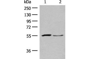 Western blot analysis of Human placenta tissue and PC3 cell lysates using SLC2A8 Polyclonal Antibody at dilution of 1:400 (SLC2A8 anticorps)