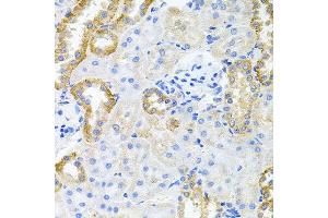 Immunohistochemistry of paraffin-embedded rat kidney using STRN3 antibody at dilution of 1:100 (x40 lens). (STRN3 anticorps)