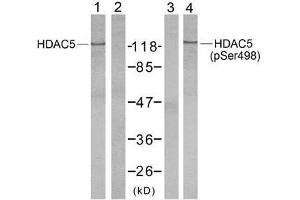 Western blot analysis of extract from NIH/3T3 cells using HDAC5 (Ab-498) antibody (E021142, Lane 1 and 2) and HDAC5 (phospho-Ser498) antibody (E011193, Lane 3 and 4). (HDAC5 anticorps  (pSer498))