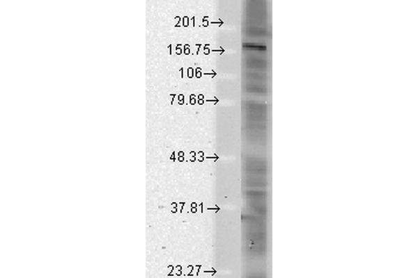 SHANK2 anticorps  (AA 84-309) (HRP)